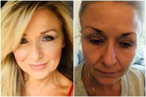 Padariusi dažną klaidą įspėja kitus: nenuvalytas makiažas įaugo į akį