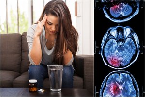 Galimai grėsmingą ligą išduoda ir galvos skausmas. Ką reikia žinoti