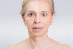 Atsikratykite raukšlių: japoniškas veido masažas daro stebuklus