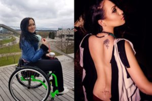 Po apmaudžių nesėkmių suluošinta vilnietė nekeikia likimo