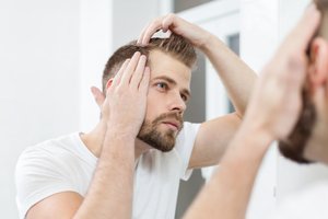 Slenka plaukai? Pasakė, kada vertėtų susirūpinti