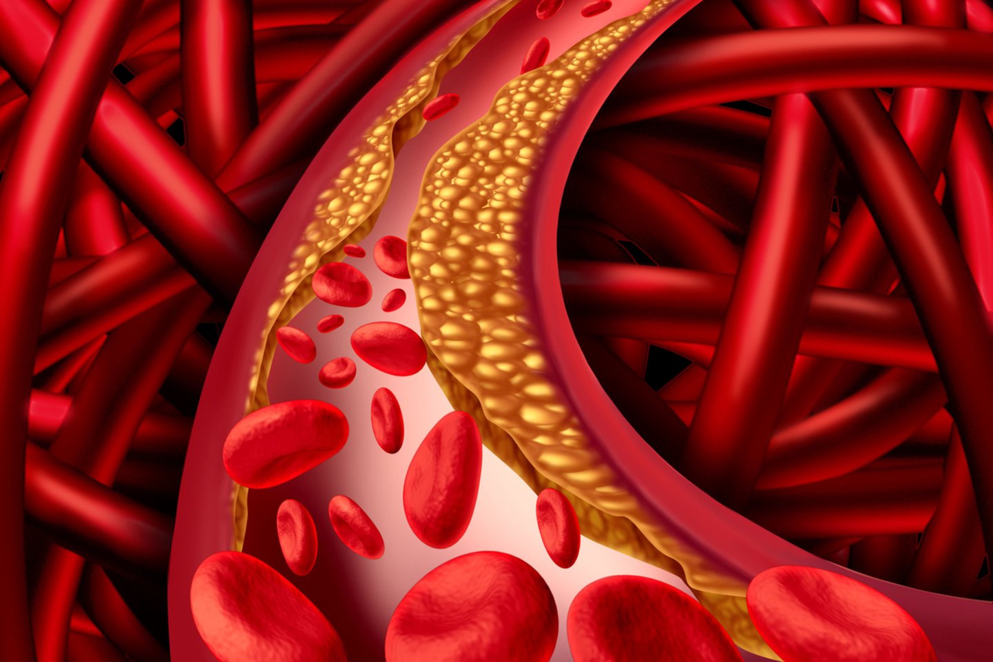  Širdies ir kraujagyslių ligos išlieka pagrindine mirties priežastimi.<br> 123rf.com nuotr.