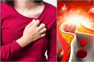 Statistika negailestinga: nuo klastingos ligos neapsaugotas nė vienas