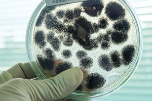 Medikai sunerimę: po ilgos pertraukos diagnozuotas buboninis maras