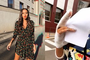 Joninių išvakarėse Karolina Meschino patyrė skaudžią traumą