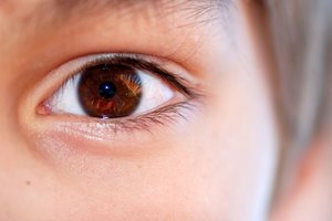 Skaudžios pasekmės: žaisdamas berniukas akyje prasidegino skylę