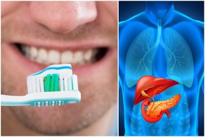 Liga prilygsta epidemijai, o būklę pabloginti gali net dantų pasta