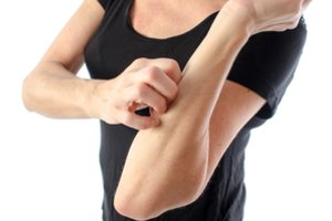 Paaiškino, kaip pagal žaizdą nustatyti, kuris vabzdys įgėlė