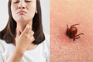 Klaidingai diagnozuota liga pavertė moters gyvenimą pragaru