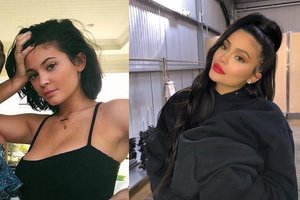 Pūstų lūpų era baigta? Kylie Jenner šokiravo savo gerbėjus