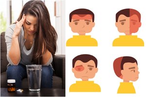 Galvos skausmo tipai: kada derėtų susirūpinti?