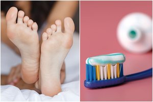 Užtepkite ant pėdų dantų pastos – rezultatas nustebins