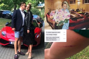 Paulius Aršauskas paviešino jųdviejų su Egle žinutes: „Jai reikia psichologų pagalbos“