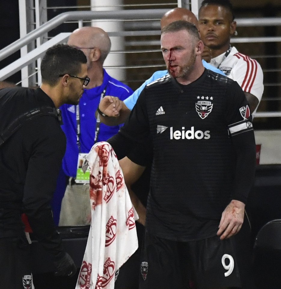  W.Rooney patyrė nosies traumą.<br> AP nuotr.