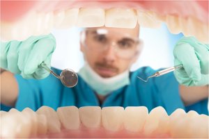 3 pagrindinės priežastys, dėl kurių susidaro dantų apnašos