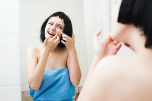 Medikė įspėjo, ko negalima daryti, jeigu veidą beria spuogai