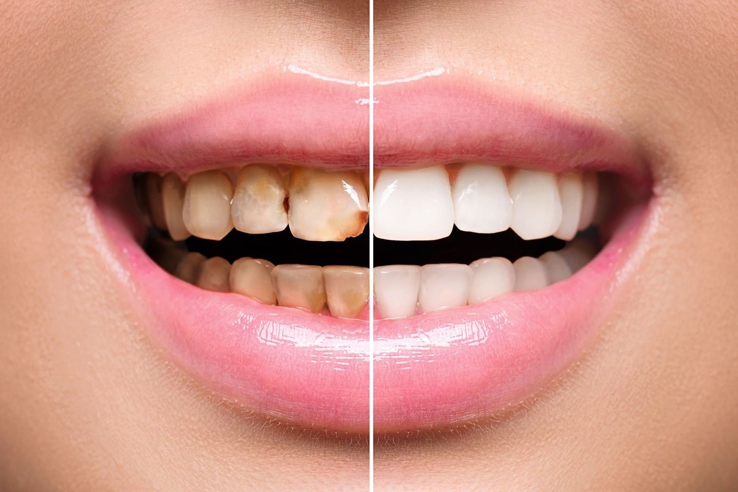  Vidutiniškai per metus žmogus sunaudoja 167 metrus dantų siūlo, 14 litrų dantų skalavimo skysčio, 3 pakuotes dantų pastos.<br> 123rf.com nuotr.