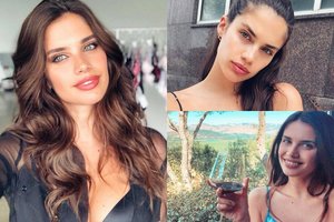 „Victoria's Secret“ modelis kenčia nuo keisto sutrikimo: be perstojo raunasi plaukus