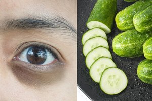 Išbandykite: 6 natūralūs būdai, padėsiantys atsikratyti tamsių paakių