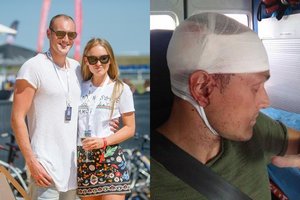 Gintarė Gurevičiūtė prašo pagalbos – stipriai sužeistas jos mylimasis