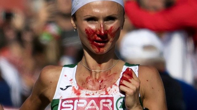 Staiga pasipylęs kraujas bėgikės nesustabdė: košmariškas ryžtas atnešė pergalę