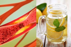 Jei jus kamuoja viena iš šių 13 bėdų, jums gali padėti vanduo su citrina