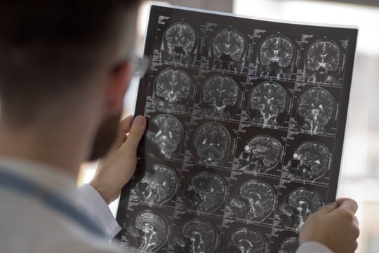 Diagnostinių tyrimų eilėje gali tekti laukti ir iki pusės metų