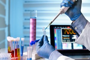 Kada norint susilaukti vaikų reikėtų atlikti genetinius tyrimus