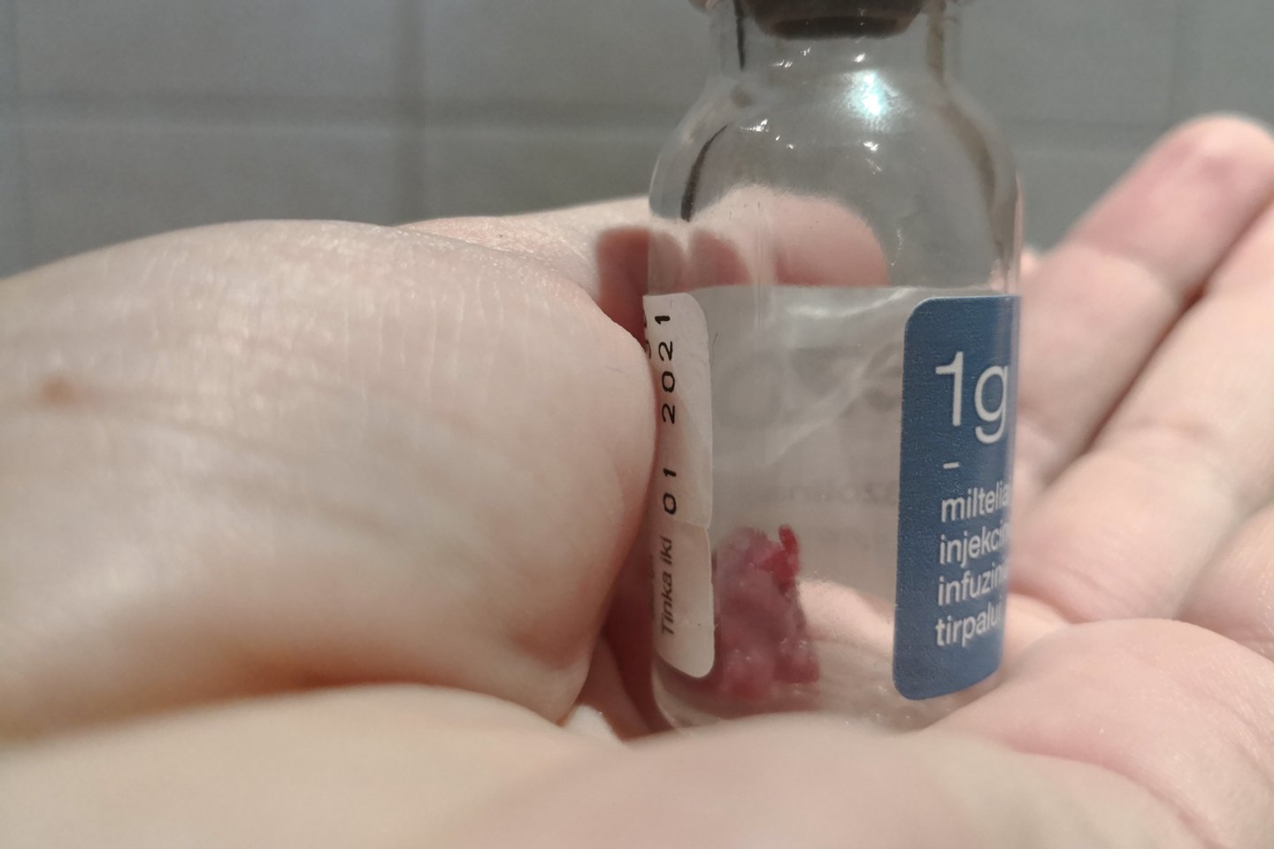Vilnietė „Lietuvos ryto“ žurnalistei parodė buteliuką su išoperuota išvarža, kurį parsivežė iš ligoninės.<br>G.Ališauskaitės nuotr.