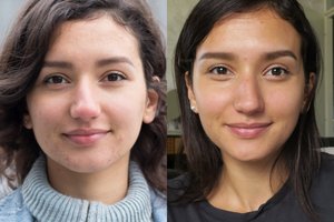 Buvusi veganė atskleidė, kaip pasikeitė sveikata ir išvaizda grįžus prie mėsos