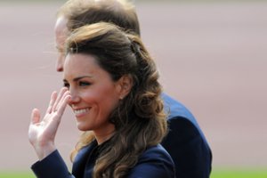 Kate Middleton ant galvos turi didžiulį randą: jo kilmę paaiškino tik iš dalies