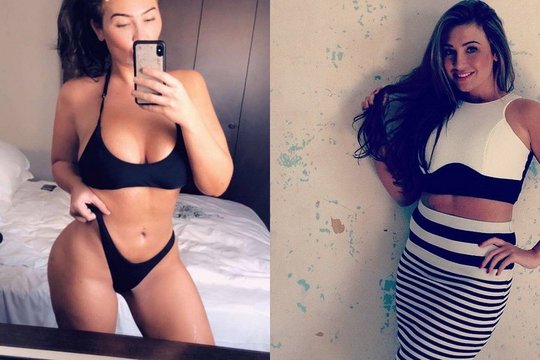 Po skyrybų su mylimuoju modelis Laurena Goodger stebina pokyčiais