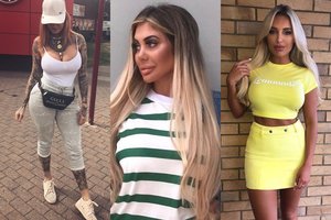 Dėl žvaigždžių pamėgto chirurgo klaidos mirė trijų vaikų mama