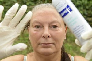 Moteris, kuri gali maudytis vos du kartus per metus: „Niekam to nelinkėčiau“