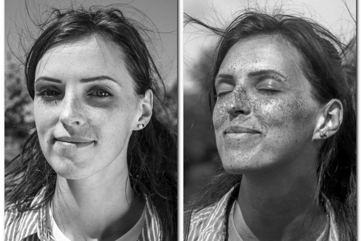 Eksperimentas atskleidė, kaip mūsų veido odą veikia saulė: kairėje fotografuota su paprasta, dešinėje – su UV kamera.<br> BENU nuotr. 