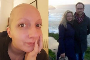 Neįtikėtina: smegenų auglio operacijos metu moteris dainavo ir juokavo