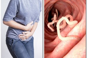 18 slaptų požymių, kad jūsų organizme yra parazitų ir kaip juos įveikti