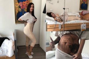 Lietuviškoji Kim Kardashian prakalbo apie skausmą po užpakaliuko didinimo operacijos