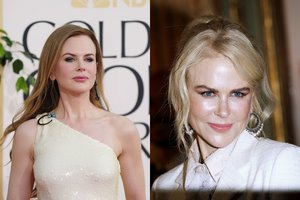 Itin jaunai atrodanti Nicole Kidman neigia priklausomybę grožio injekcijoms