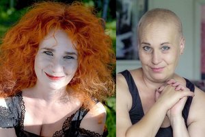 Nuo visų sunkią ligą slėpusi Jūratė Rekevičiūtė ryžosi skausmingai išpažinčiai