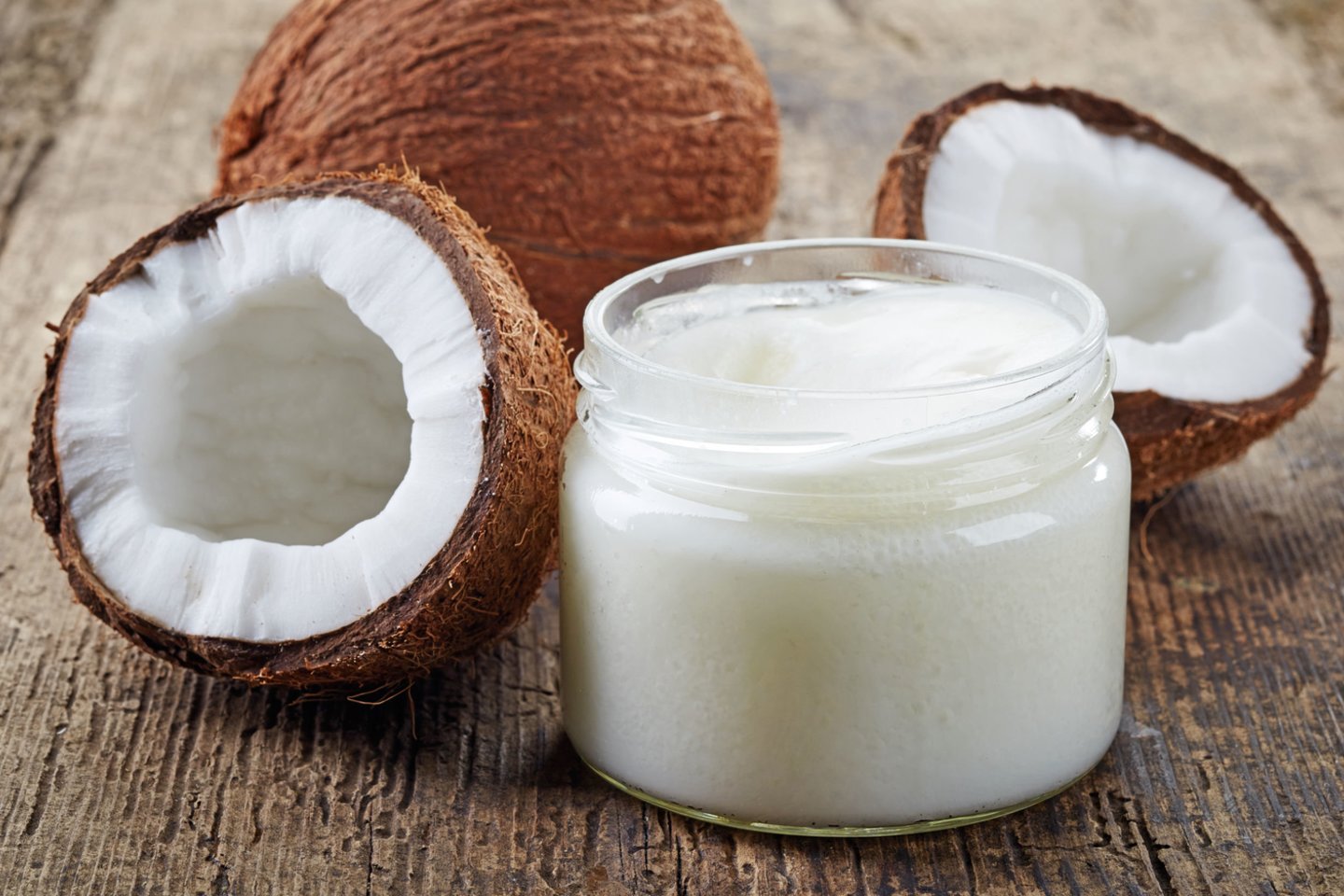  Kokosų aliejus iš tiesų gali kenkti sveikatai – ypač jeigu jį naudosime nesaikingai.<br> 123rf nuotr.
