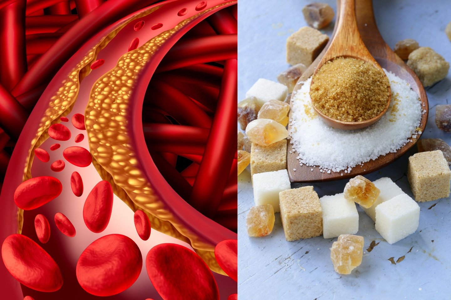  Cukrus – tai blogis, kuris pažeidžia arterijas, sukelia nutukimą bei padidina kraujospūdį.<br> 123rf nuotr.