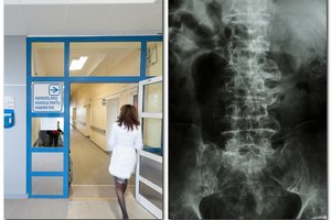 Dėl medikų klaidos radviliškietei teko kęsti nežmoniškus skausmus