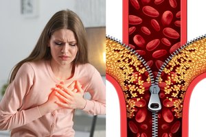 Mumijų tyrimai parodė svarbią cholesterolio padidėjimo priežastį