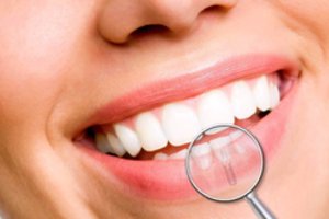 Prarasti dantys – ne tik estetinė problema