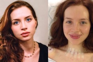 Moters nuotraukoje užfiksuotas guzelis buvo vėžio simptomas