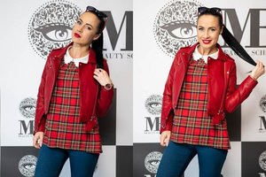 Ingrida Kazlauskaitė papasakojo, kaip atsigavo po rizikingos grožio procedūros