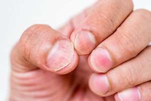 Nagai išduos, kas vyksta jūsų organizme: kai kurių požymių nevalia ignoruoti