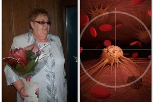 Po vyro mirties kupiškietę Bronę užklupo bėdos: vėžys smogė net tris kartus