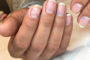 Papasakojo, kaip išlaikyti sveikus ir gražius nagus: patarimai pravers kiekvienam